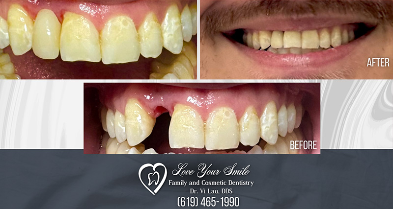 Love Your Smile Dentistry | Emergency Treatment, Implant Dentistry and Dental Fillings